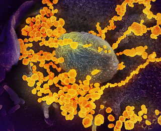 An image of the virus that causes COVID-19 emerging from a cell
