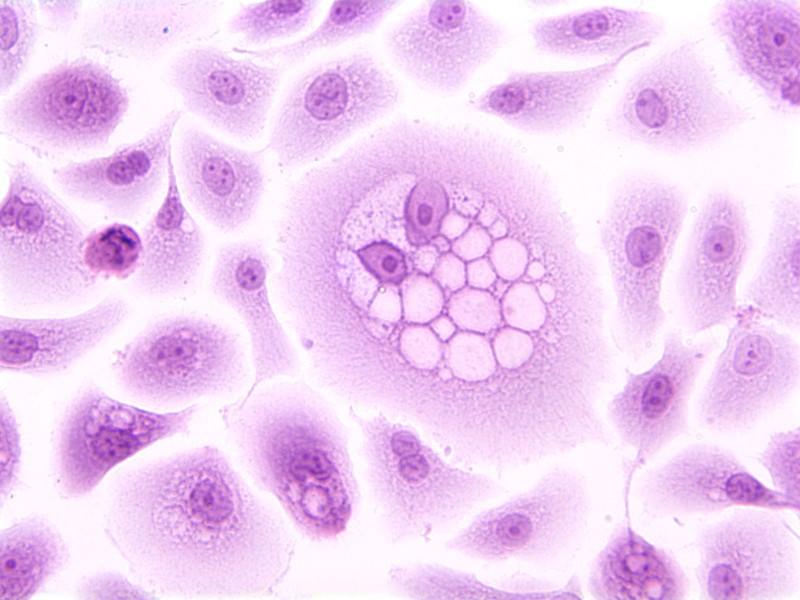 HPV oncoprotein