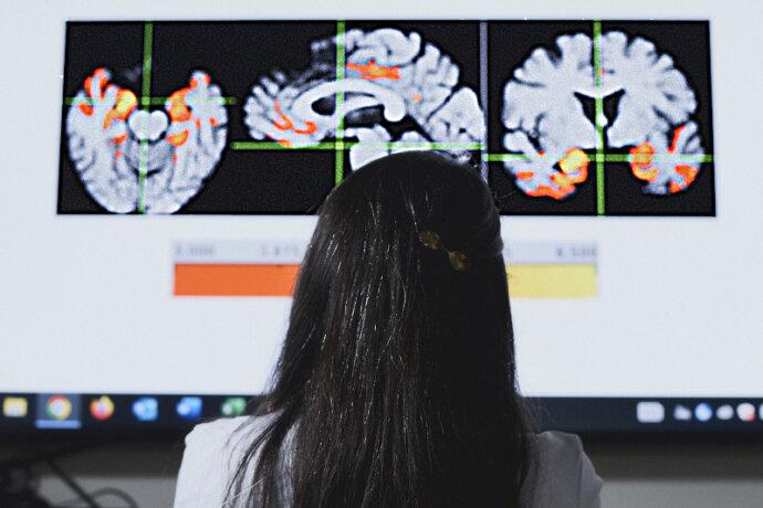 a woman stands in front of a screen of brain images.
