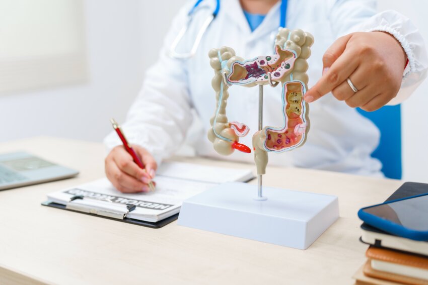 A doctor holds a human colon anatomy model, demonstrating the digestive system's structure to diagnose and treat various gastrointestinal diseases and conditions.
